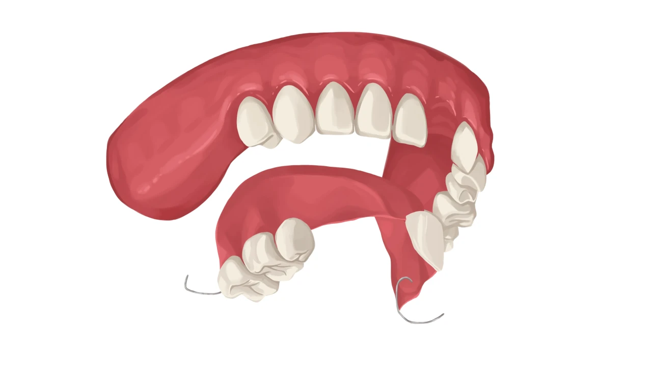 Partial Dentures Service Image